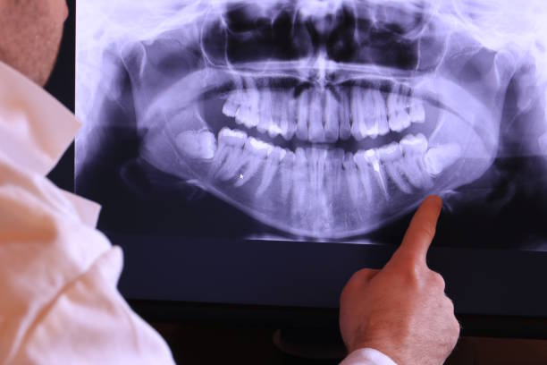 Best Emergency Cosmetic Dentistry (e.g., broken veneers) in Loma Ri, CA