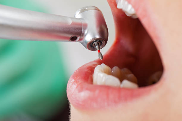 Best Emergency Root Canal Therapy in Loma Ri, CA
